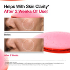 ANUA Niacinamide 10% + TXA 4% Dark Spot Correcting Serum