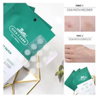 VT Cica Acne Spot Patch